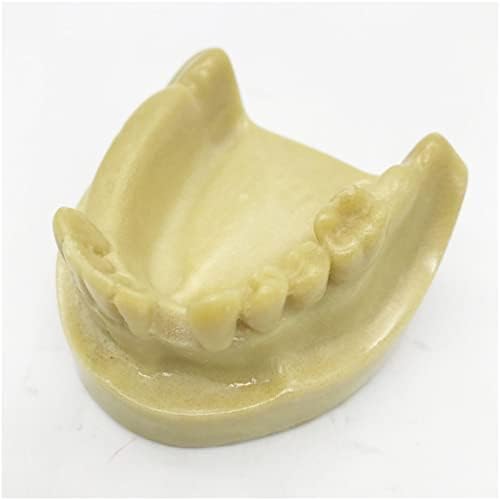 Модел на зъбите KH66ZKY Демонстрационен Модел на Зъбен Имплант Модел Имплант Долната Половина на Устата Пенящийся Отсъствуващ